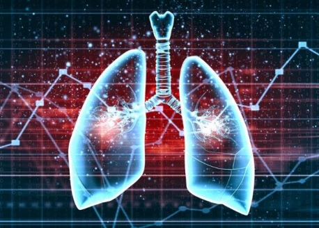 世界慢阻肺日 提醒大家關注肺部健康
